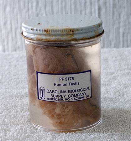 PICTURE: color photo of unwrapped and ready to open glass jar containing the embalmed human testicle.