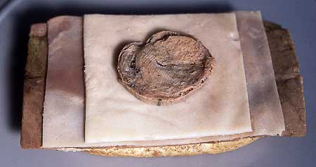 PICTURE: color photo of a slice of human testicle on top of slices of chicken, ham and beef piled on a biscuit.